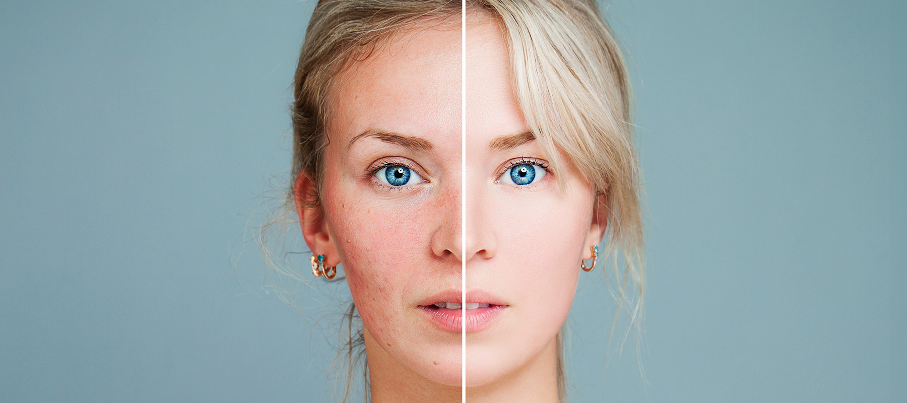 Woman's face showing the difference between clear 
