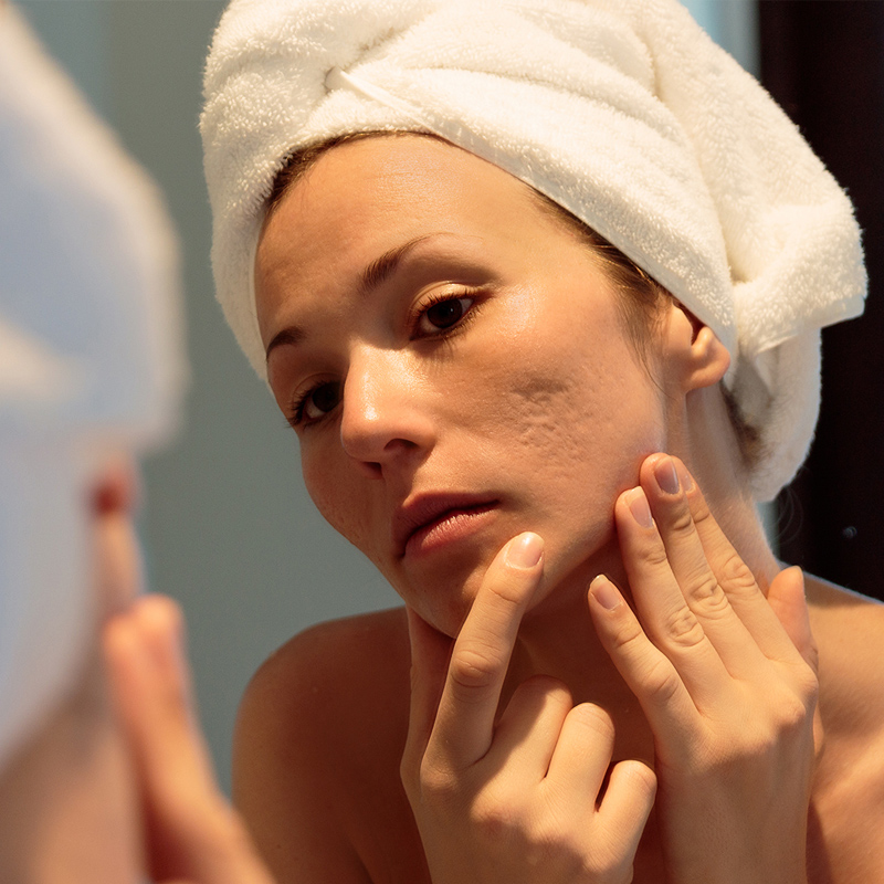 woman applying cream