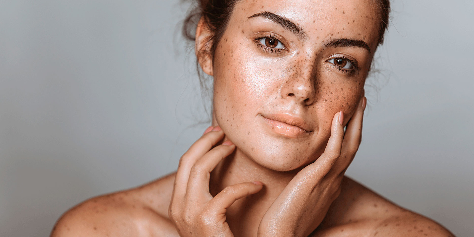 Woman face with dark spots