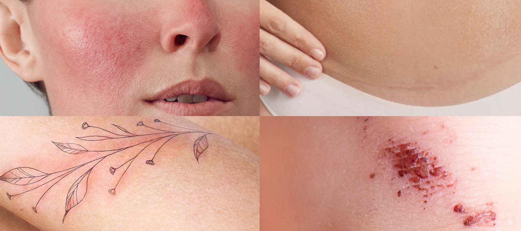 Cicabio Crème+ covering more than 25 indications