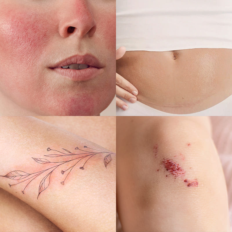 Cicabio Crème+ covering more than 25 indications